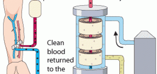 Understanding dialysis and how a dialyzer works